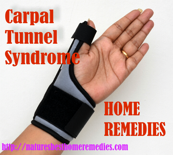 carpal tunnel syndrome home treatment
