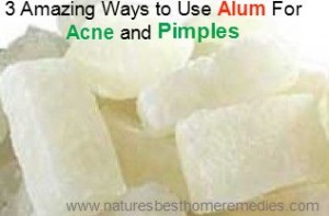 Alum for acne and pimples