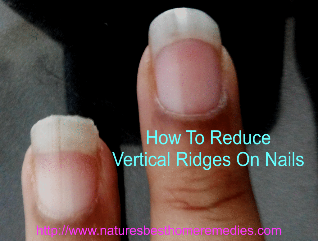 How To Get Rid of Vertical Ridges On Fingernails | Get Rid of Nail Ridges  Using Home Remedies -