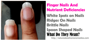 fingernails and nutrient deficiencies