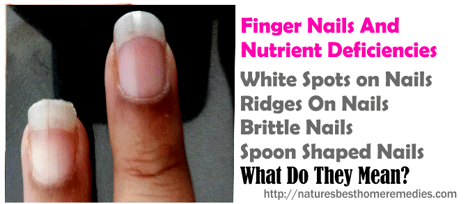 fingernails and nutrient deficiencies