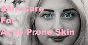 care routine acne prone skin