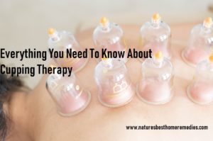 cupping therapy what to expect