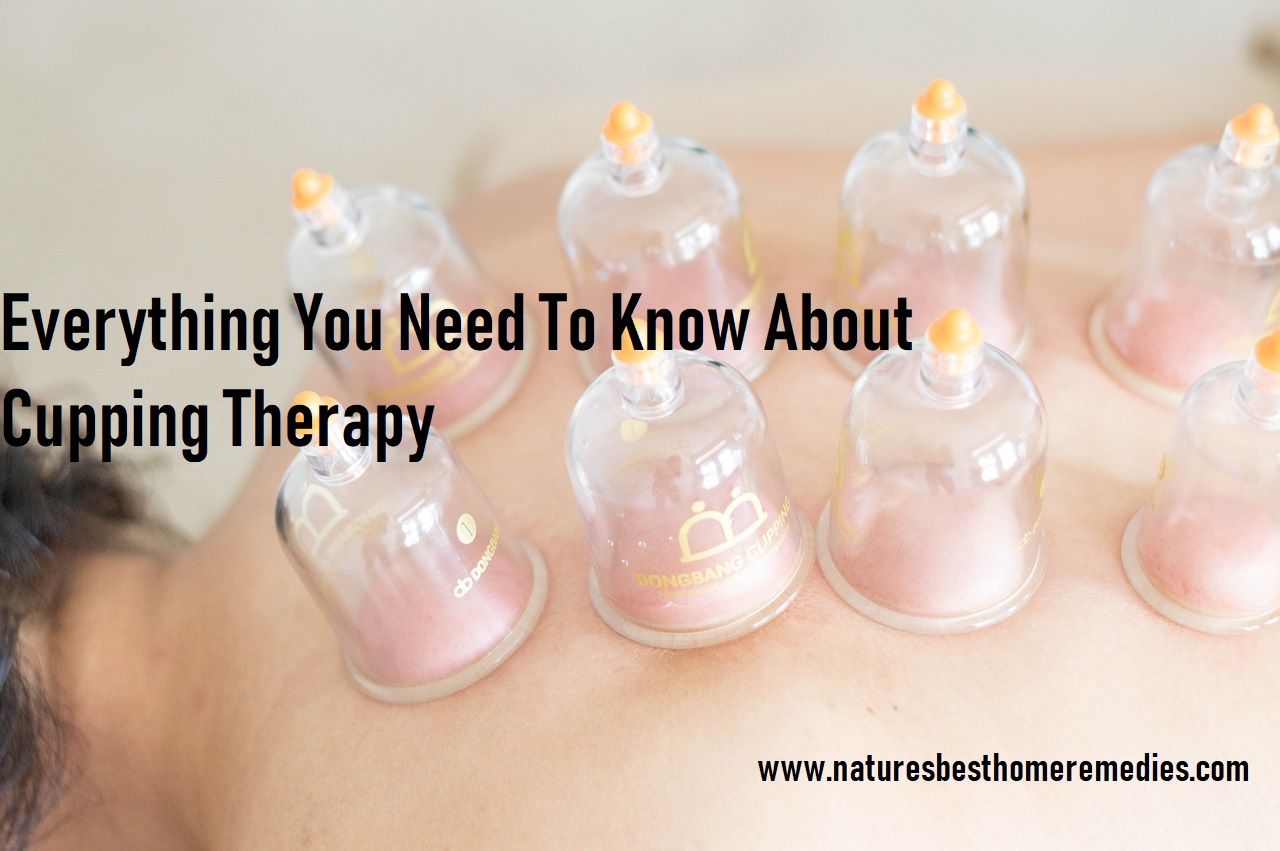 cupping therapy what to expect