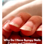 Why Do I Have Bumpy Nails ridges