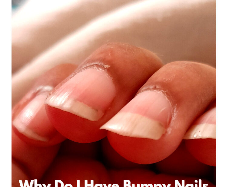 Why Do I Have Bumpy Nails ridges