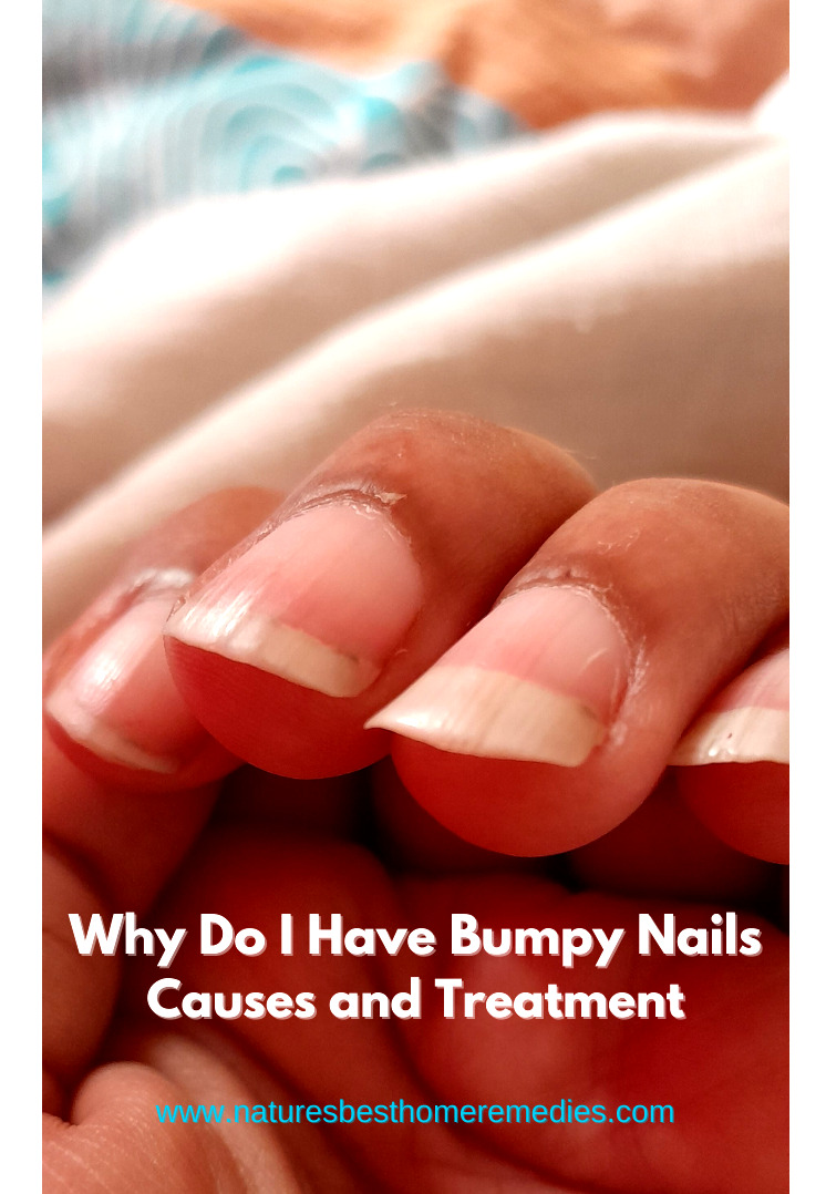 Why Do I Have Bumpy Nails -